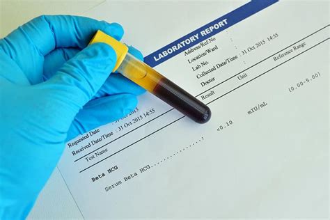 beta hcg results|Blood Test Beta hCG: How its work and what the result mean.